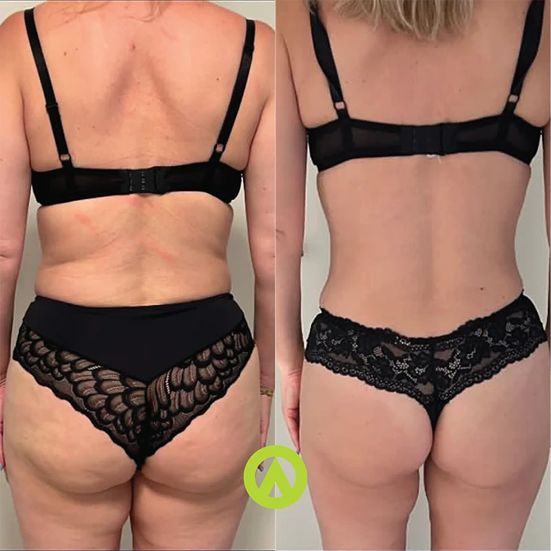 Nómada_Transformation_6
